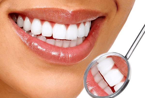 برترین روش های سفید کردن دندان ها